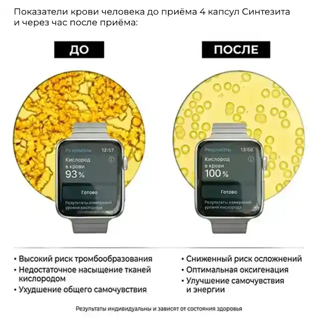 Наглядный эффект минерала Синтезит на красные кровяные тельца в сердечно-сосудистой системе