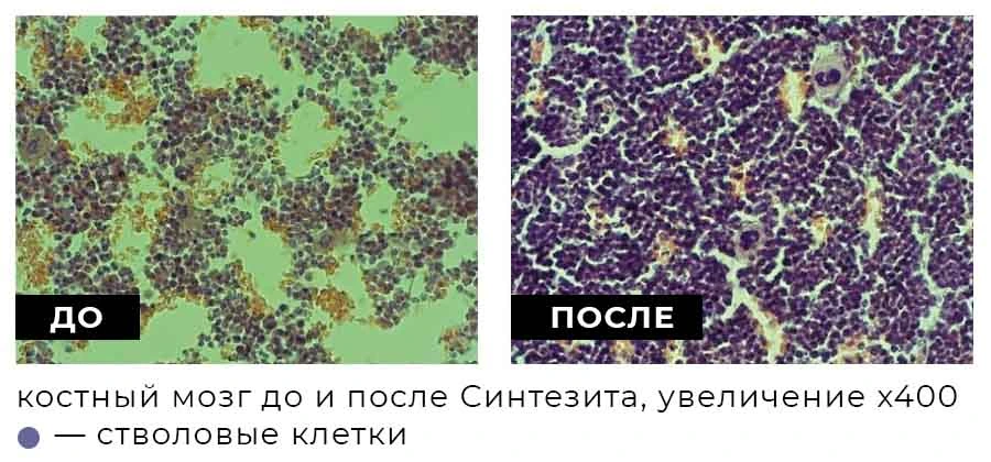 Костный мозг подопытной мыши до и после Синтезита, изображение с микроскопа